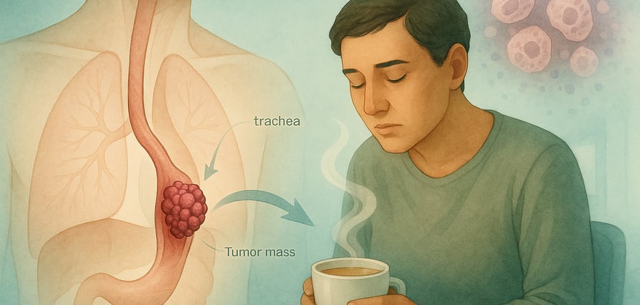 Carcinoma Of Esophagus | March